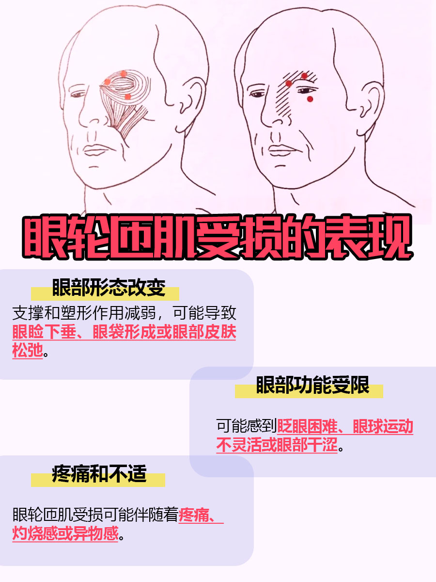 眼轮匝肌受损,这表现不容忽视!