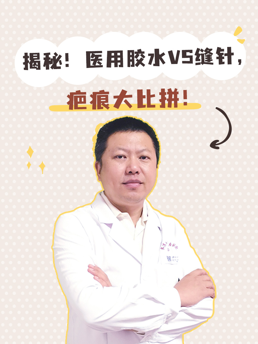 揭秘！医用胶水VS缝针，疤痕大比拼！