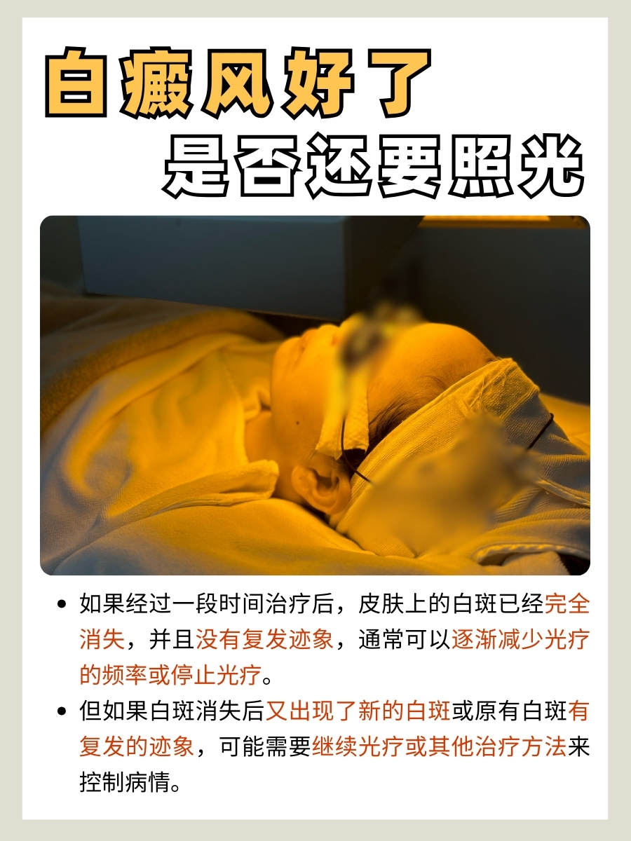 家人们,白癜风康复后,照光与否该如何抉择?