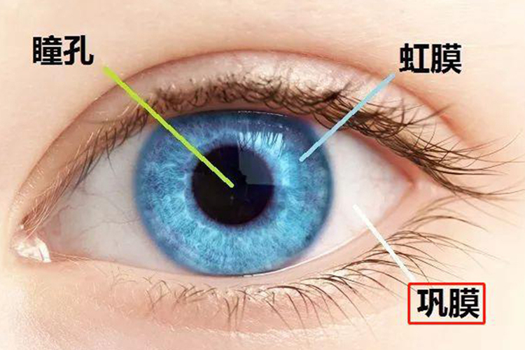 正常巩膜图