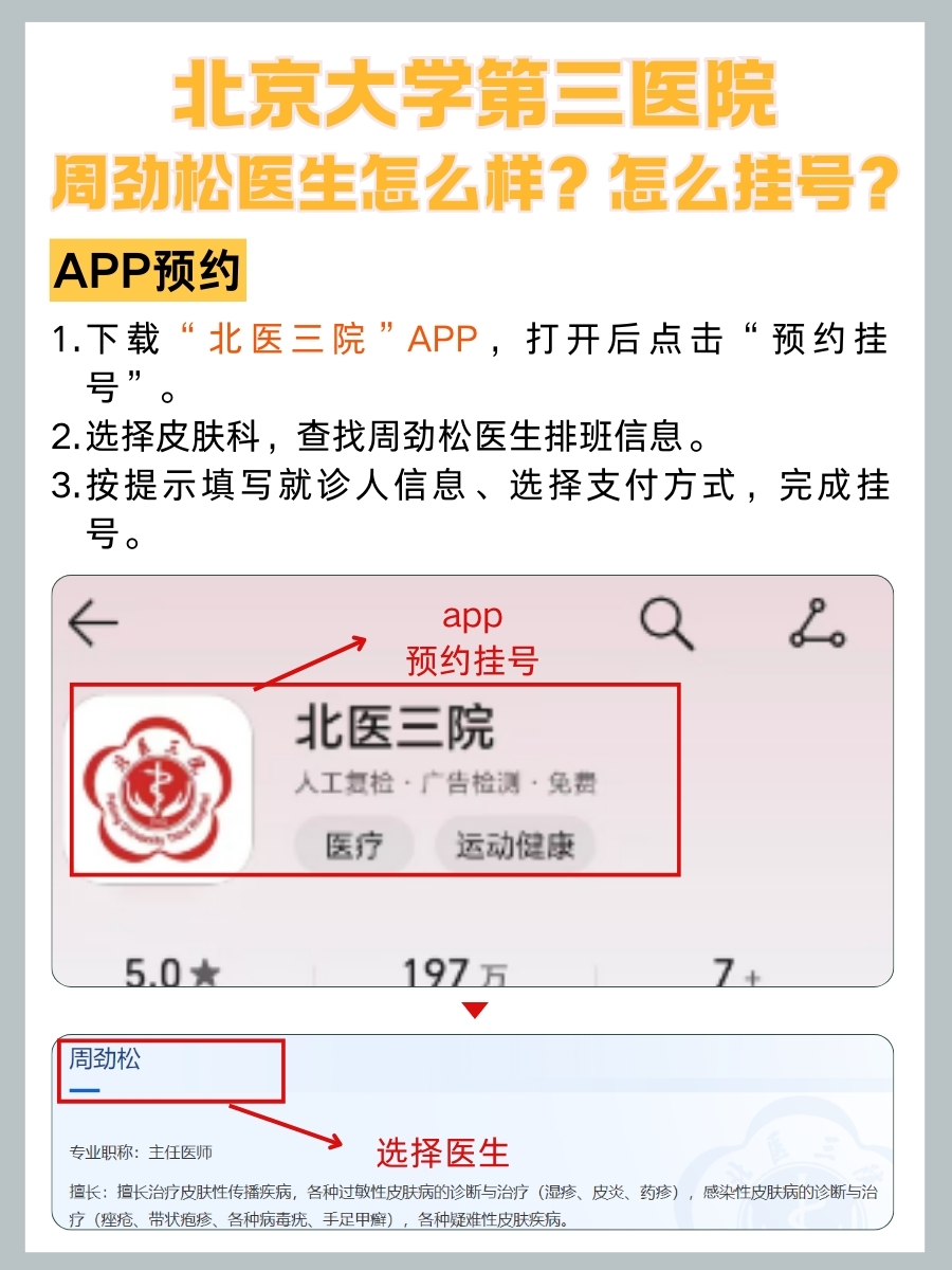 北京大学第三医院周劲松医生怎么样?怎么挂号?