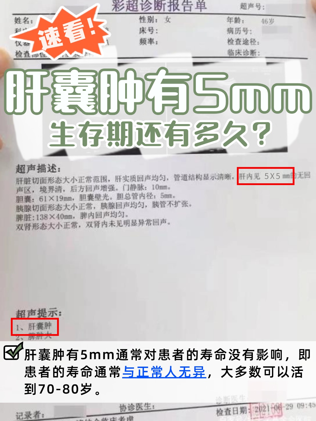 速看!肝囊肿有5mm,生存期还有多久?