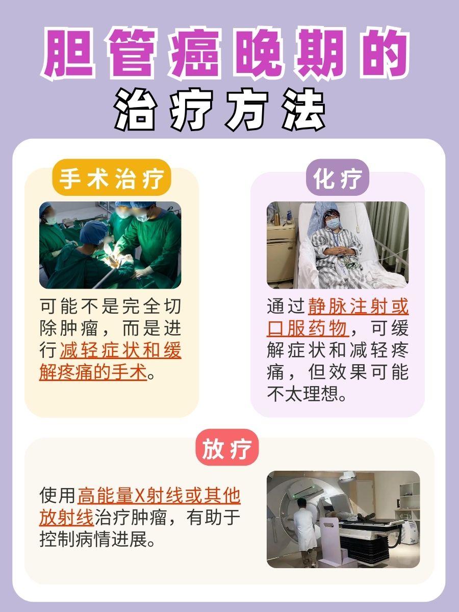 惊！胆管癌晚期也能活16年？真的吗？