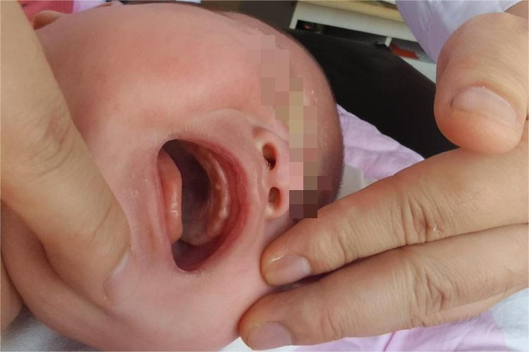 婴儿嘴里长马牙图 婴儿嘴里长马牙图