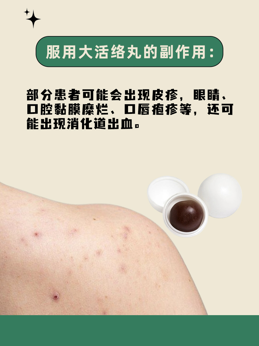 大活络丸|不仅体积“大”，还有这些功效与作用