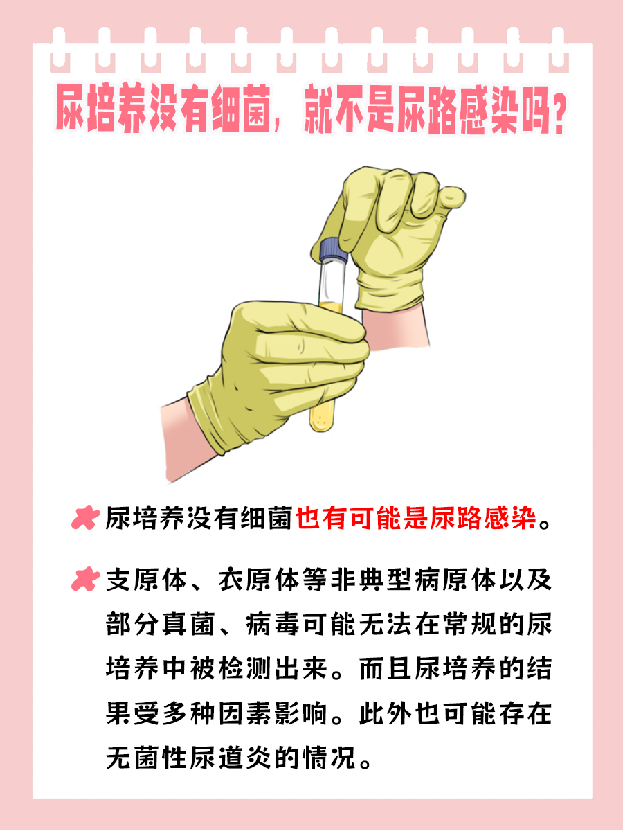 带你了解:尿培养没有细菌,就不是尿路感染吗