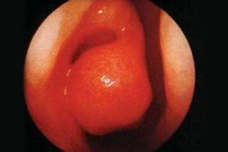 鼻甲上有肉球图