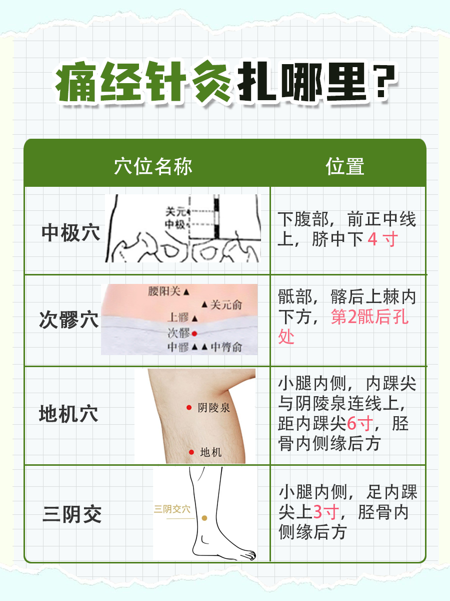 医生解析：痛经针灸扎哪里