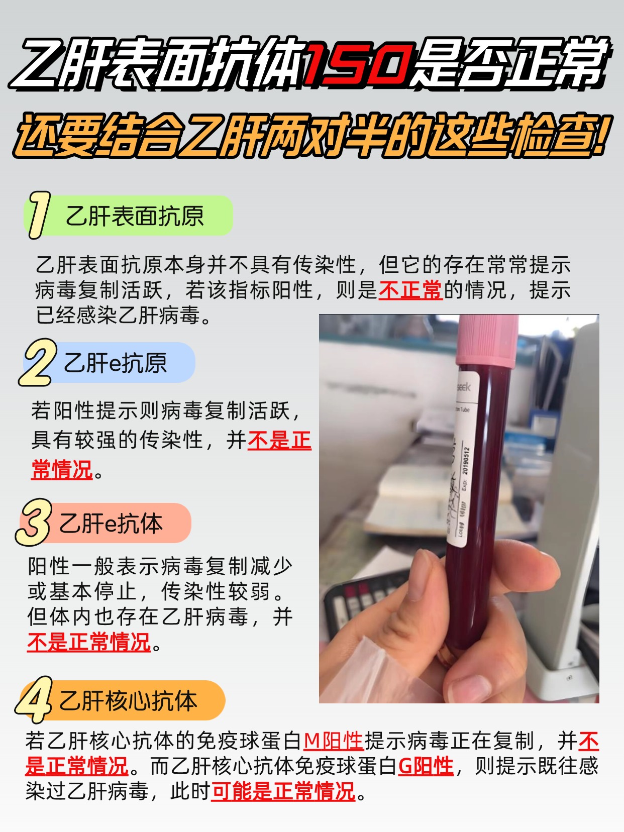 乙肝表面抗体150算高还是低？这篇给你讲清楚