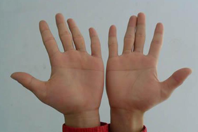 皮肤纹理异常图