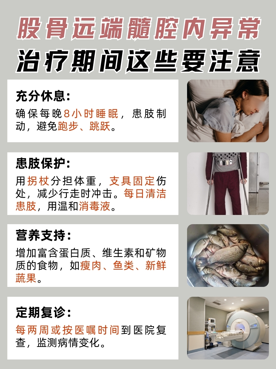 股骨远端异常？髓腔内信号变化需留意