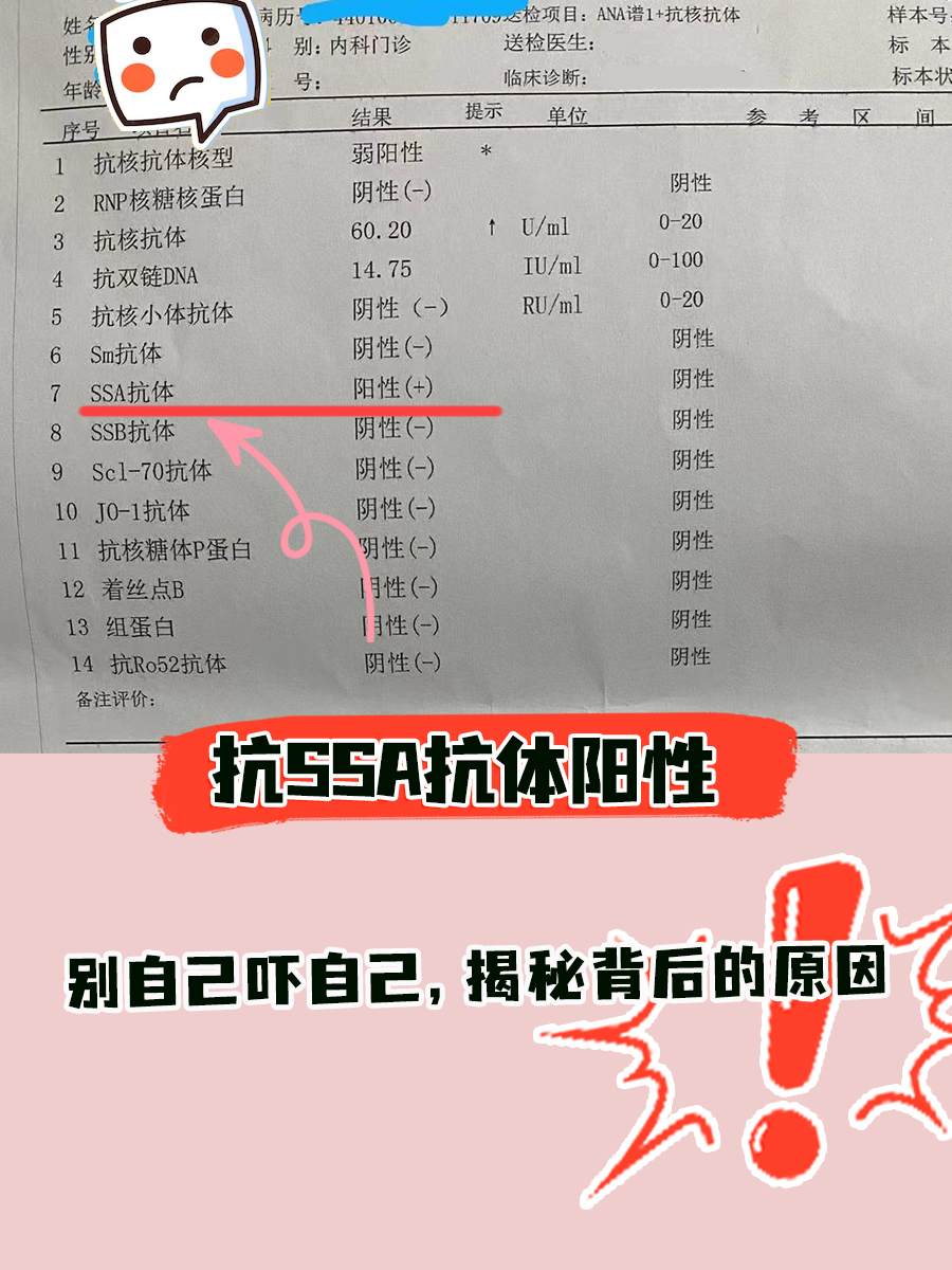 抗SS-A抗体阳性，揭秘背后的原因