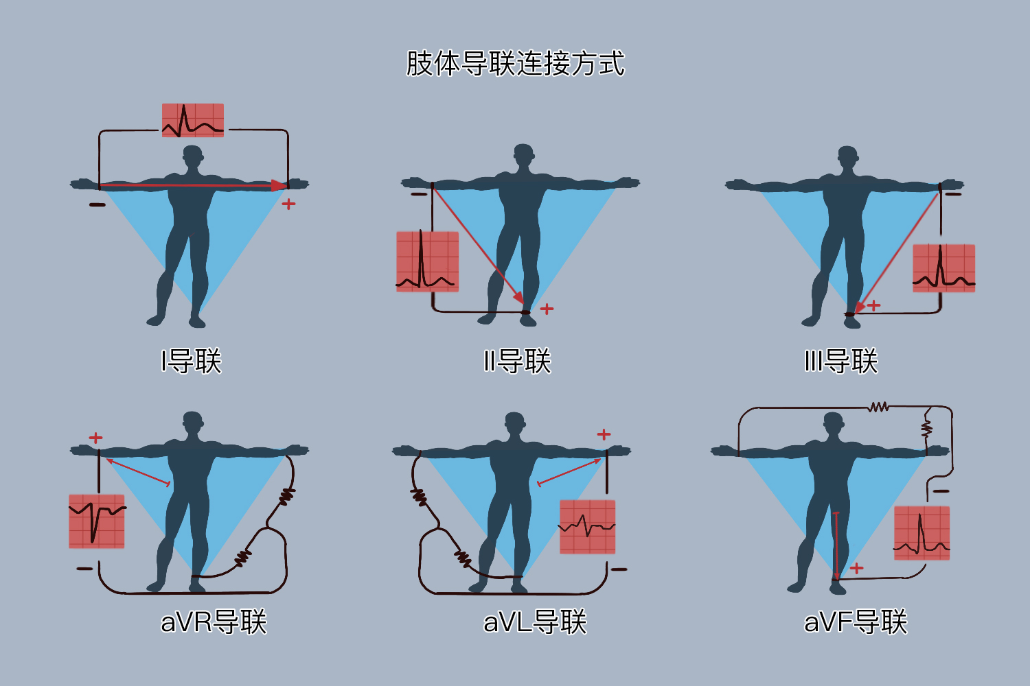 肢体导联连接图