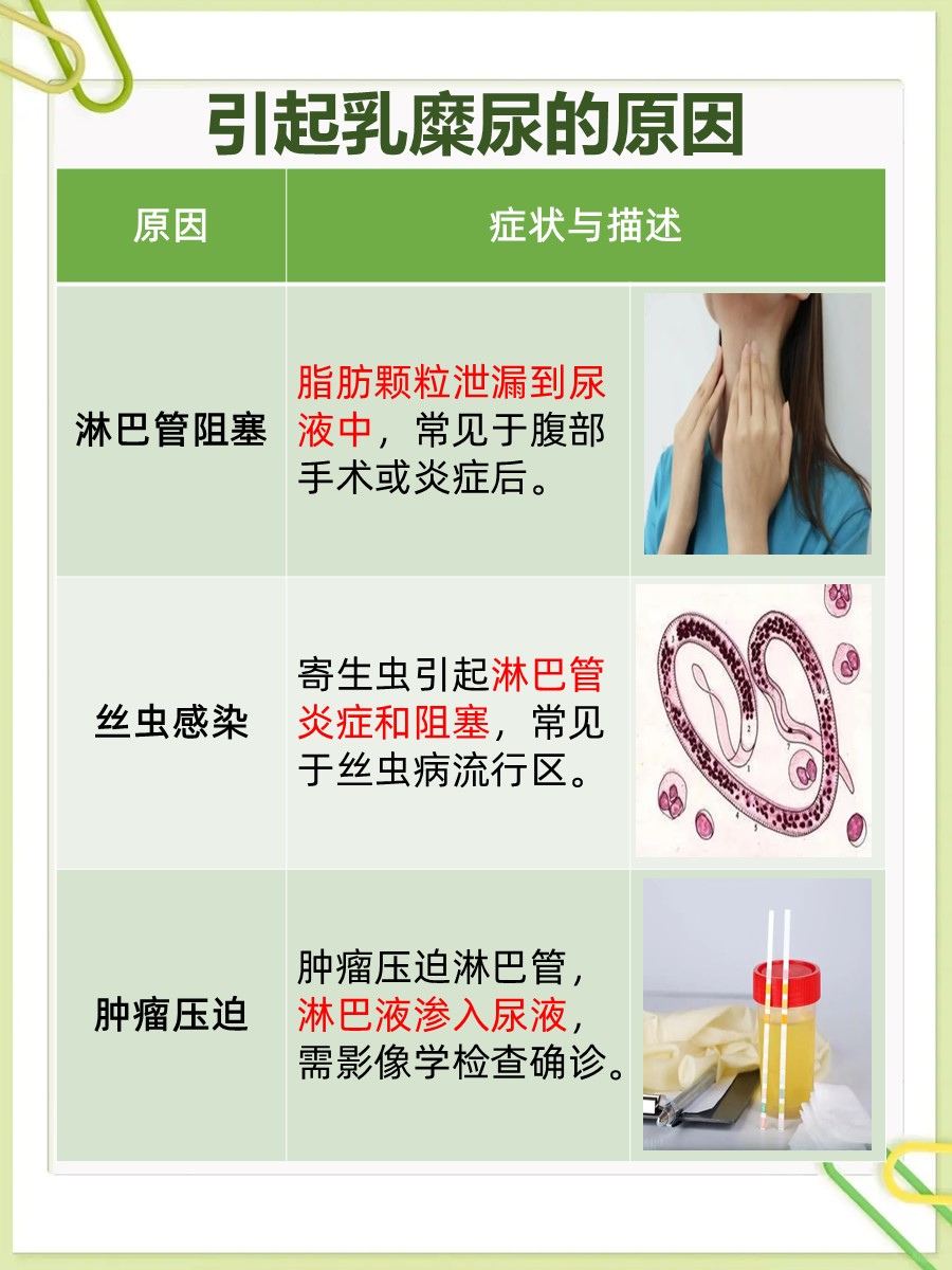 乳糜尿是什么原因引起的？常见病因分析