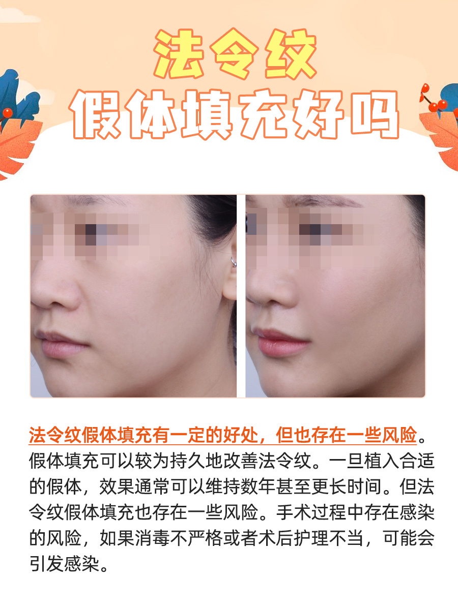 法令纹假体填充好吗 ？一文揭秘