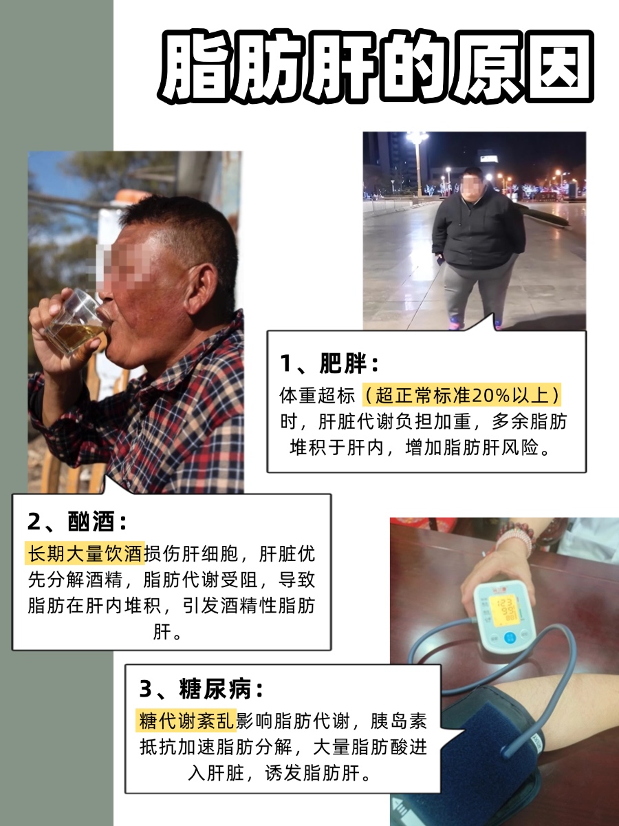 脂肪肝什么原因,怎么治疗?应对方法来啦!