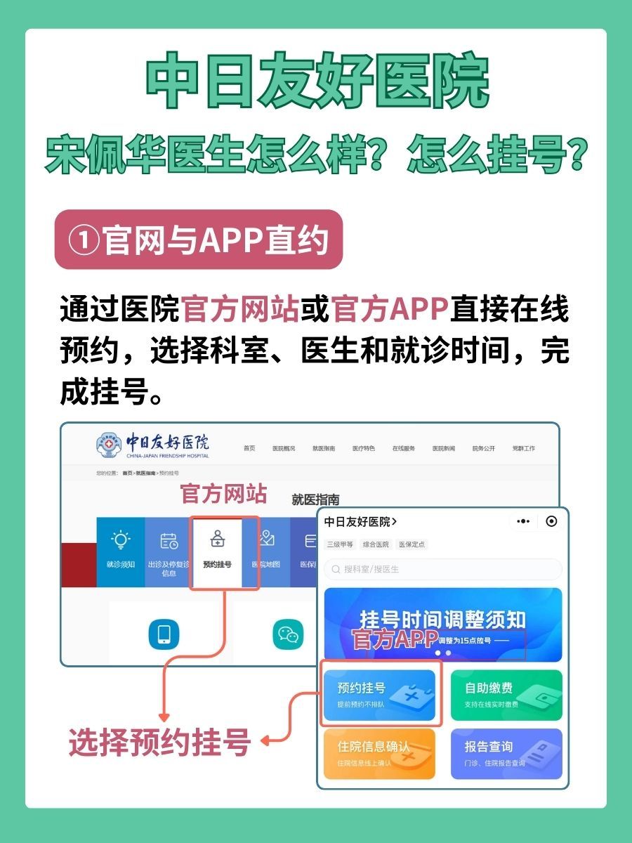 中日友好医院宋佩华医生怎么样？怎么挂号？