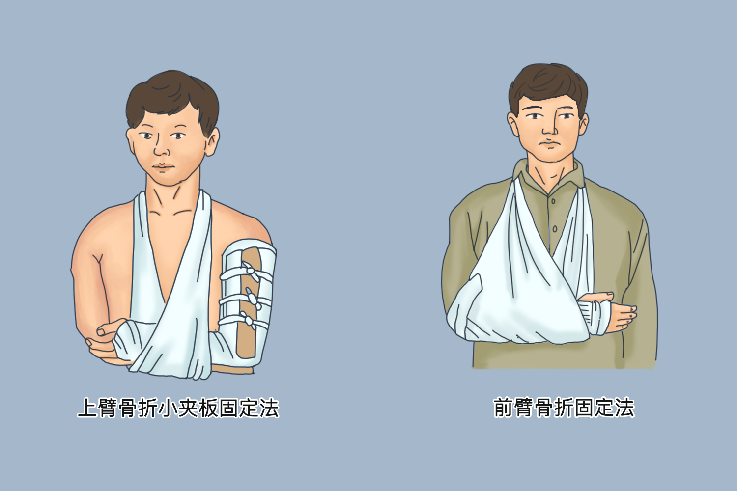 手臂骨折吊带绑法图