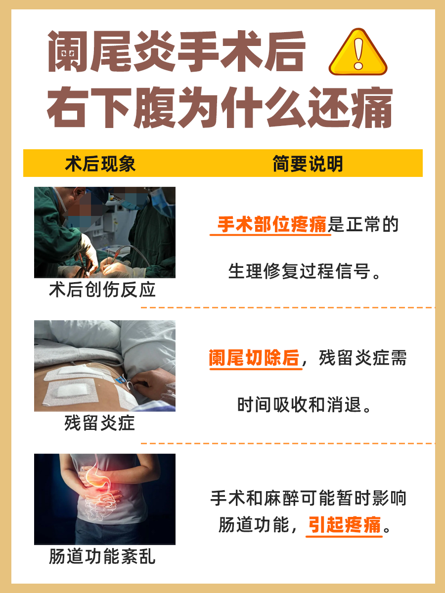 阑尾炎手术后右下腹持续痛感之原因解析