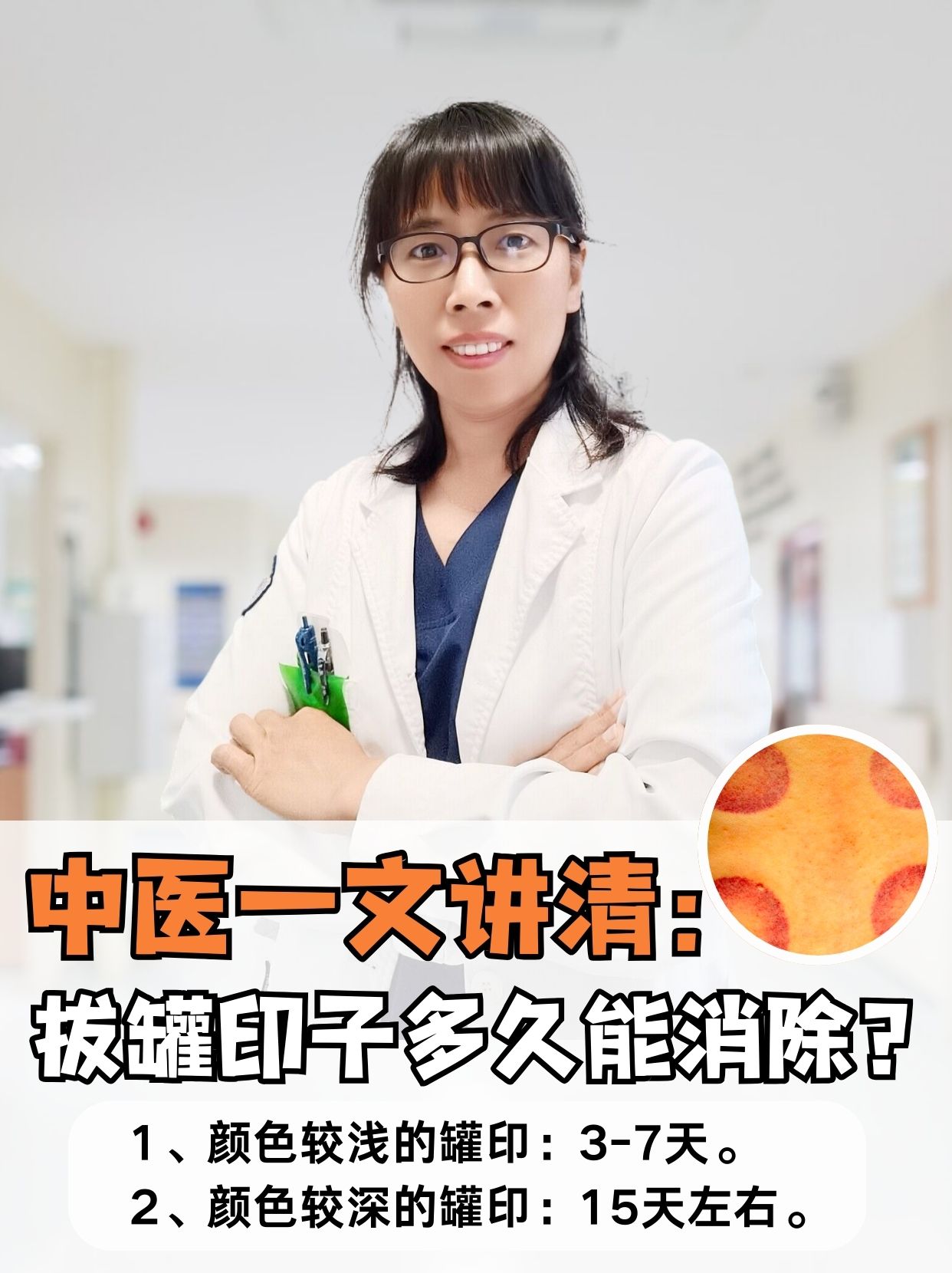 中医一文讲清：拔罐印子多久能消除？
