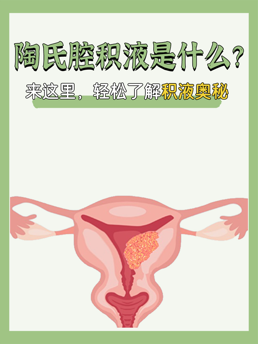 陶氏腔积液是什么？来这里，轻松了解积液奥秘