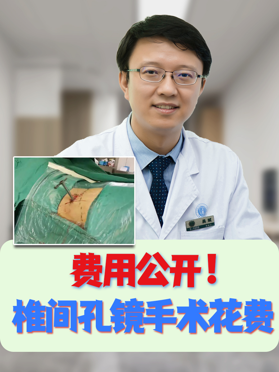 费用公开！椎间孔镜手术花费