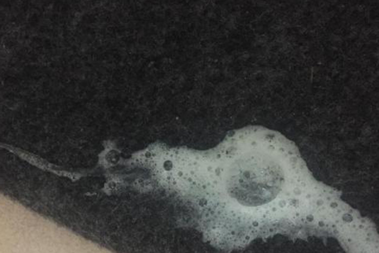 白色泡沫痰图 白色泡沫痰图