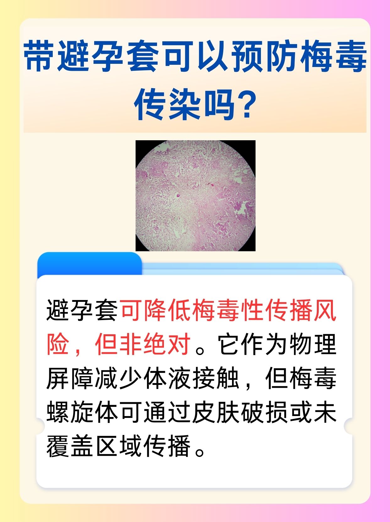 解析：带避孕套可以预防梅毒传染吗