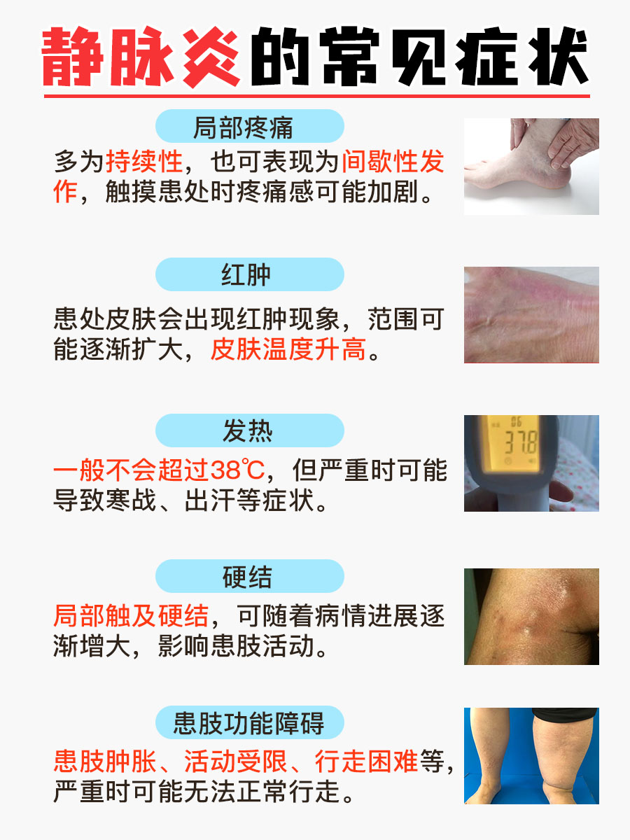 静脉炎的关键症状,你捕捉到了吗?