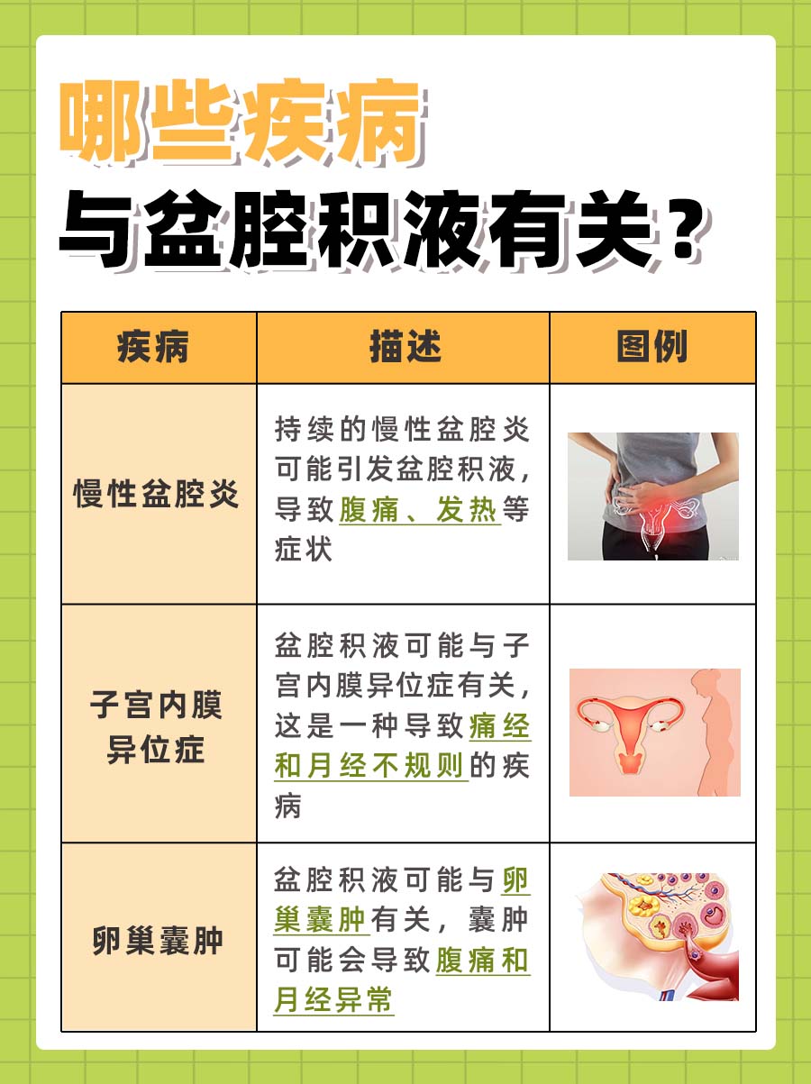 盆腔积液多少是正常范围？医生告诉你