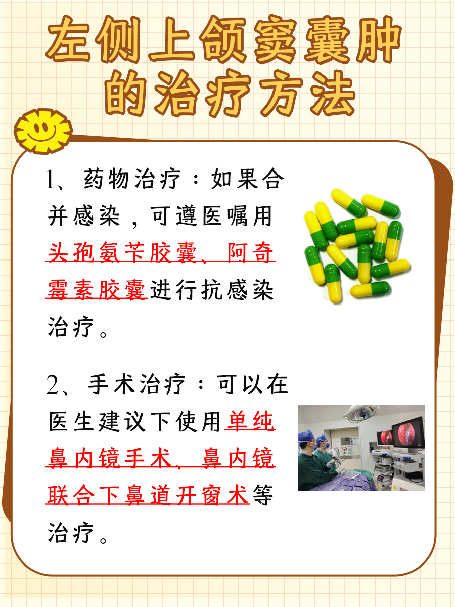 解惑:左侧上颌窦囊肿需要治疗吗