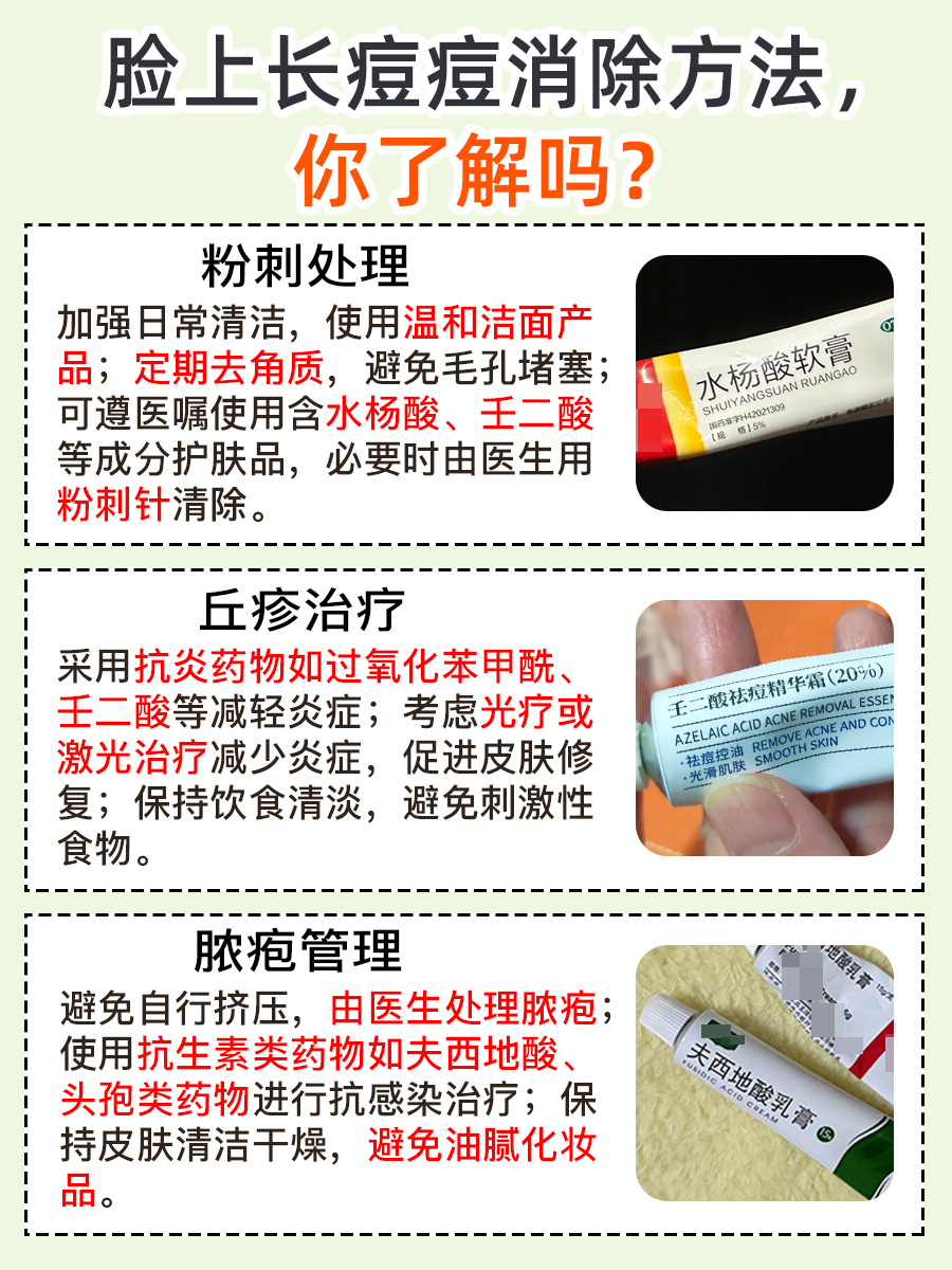 脸上长痘不用愁,专家教你快速消除法!