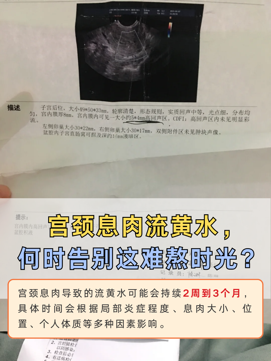 宫颈息肉流黄水，何时告别这难熬时光？