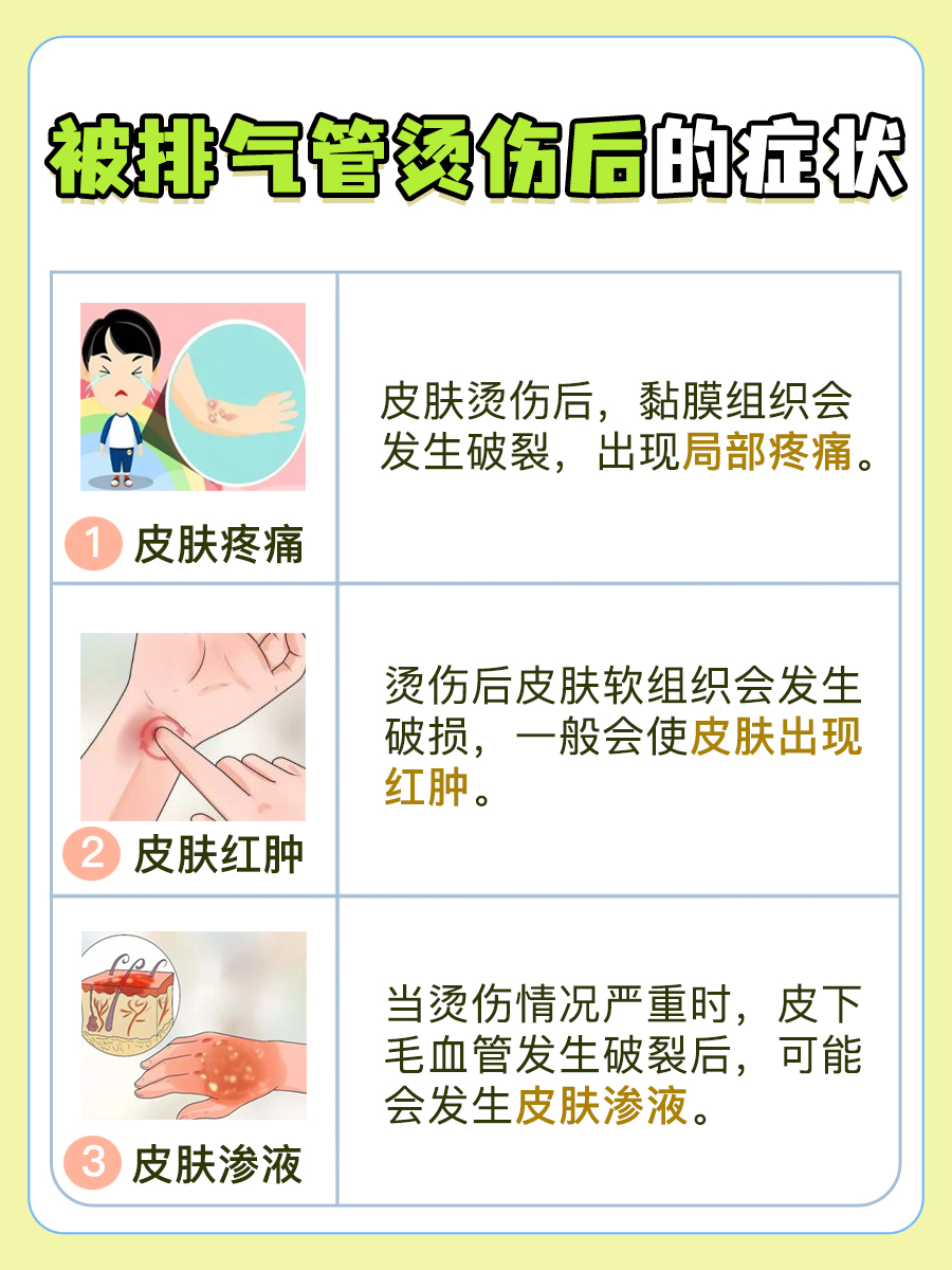 被排气管烫伤,别急,治疗方法来啦!