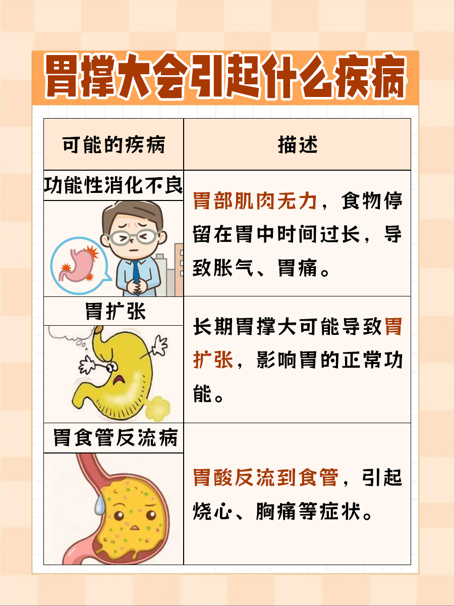 胃撑大:怎样才能轻松减下去?