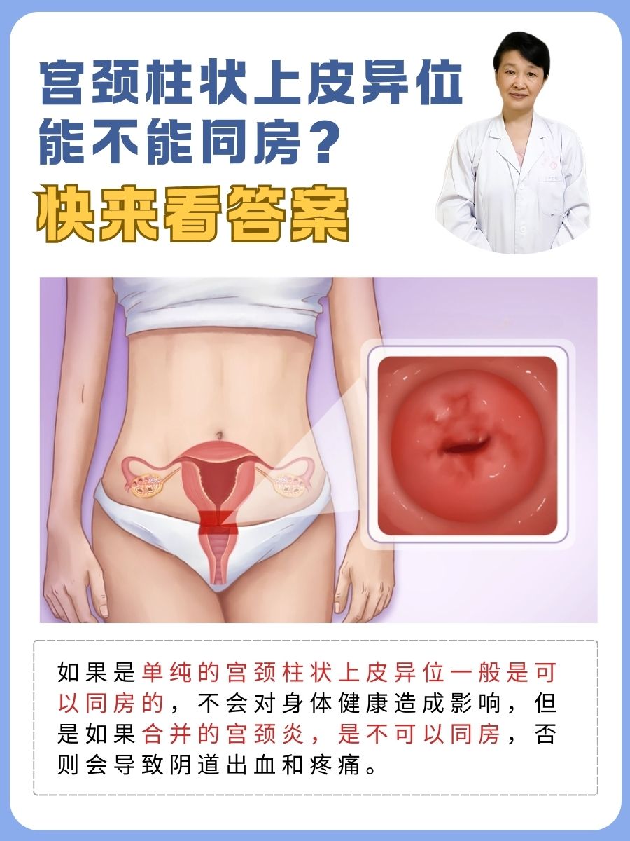 宫颈柱状上皮异位能不能同房？快来看答案