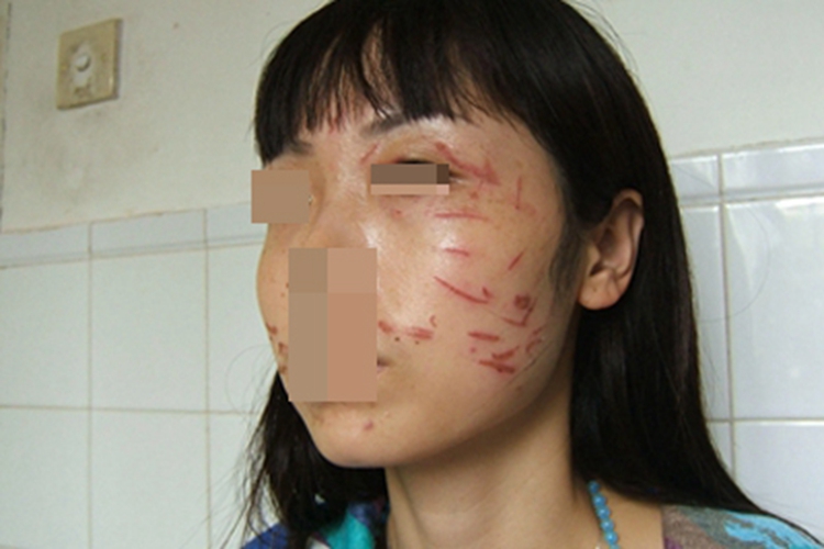 人工皮炎面部条纹图