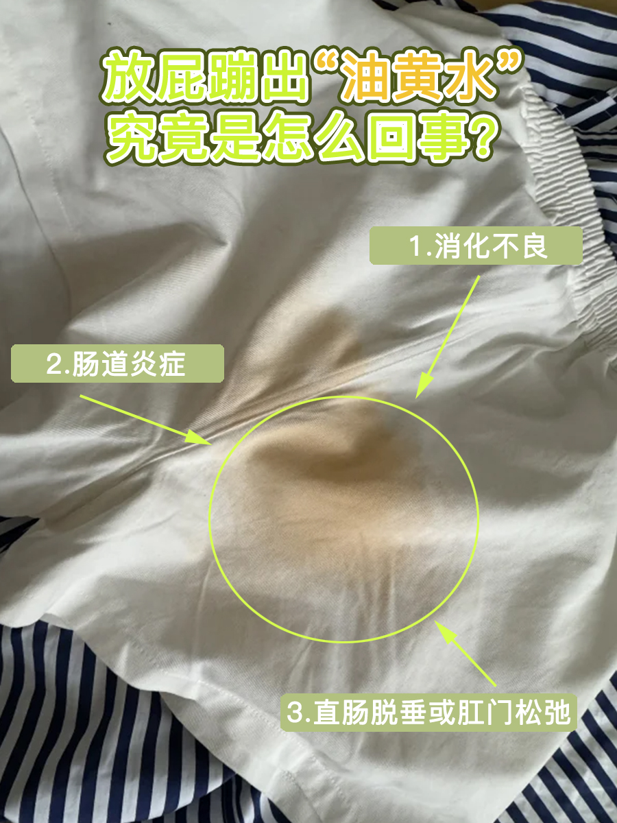 放屁蹦出“油黄水”,究竟是怎么回事?