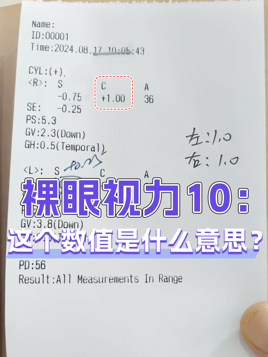 裸眼视力10：这个数值是什么意思？