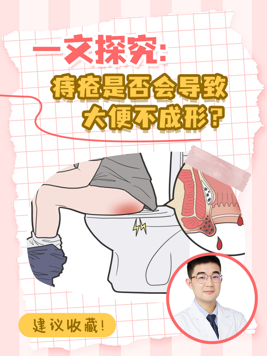一文探究:痔疮是否会导致大便不成形?