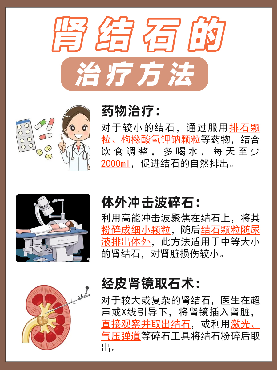 肾结石的症状表现你了解吗？速来围观