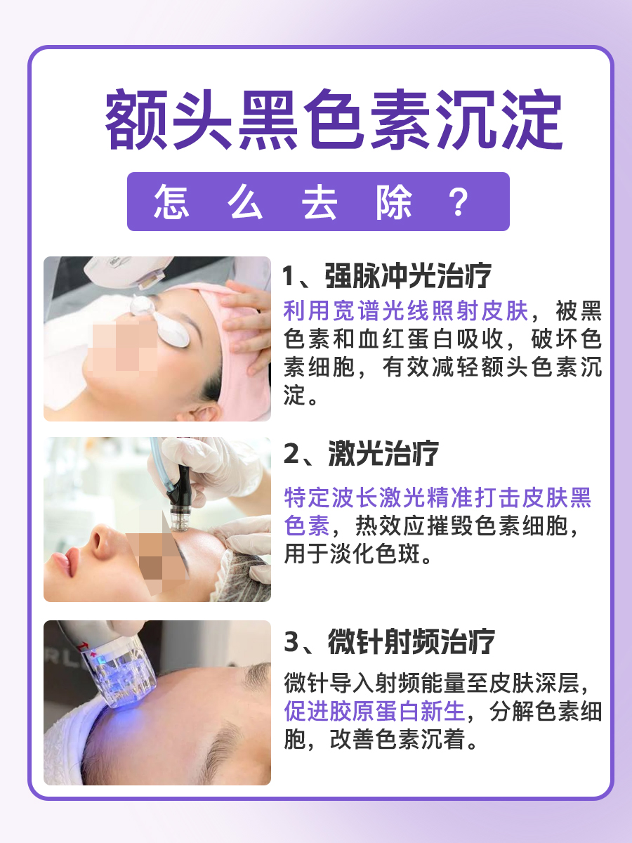 额头黑色素沉淀怎么去除？真相来了