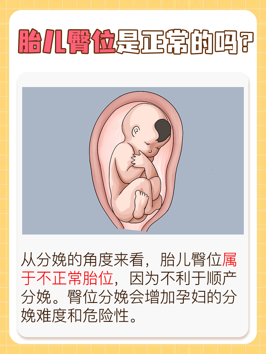 深入了解：胎儿臀位是正常的吗？