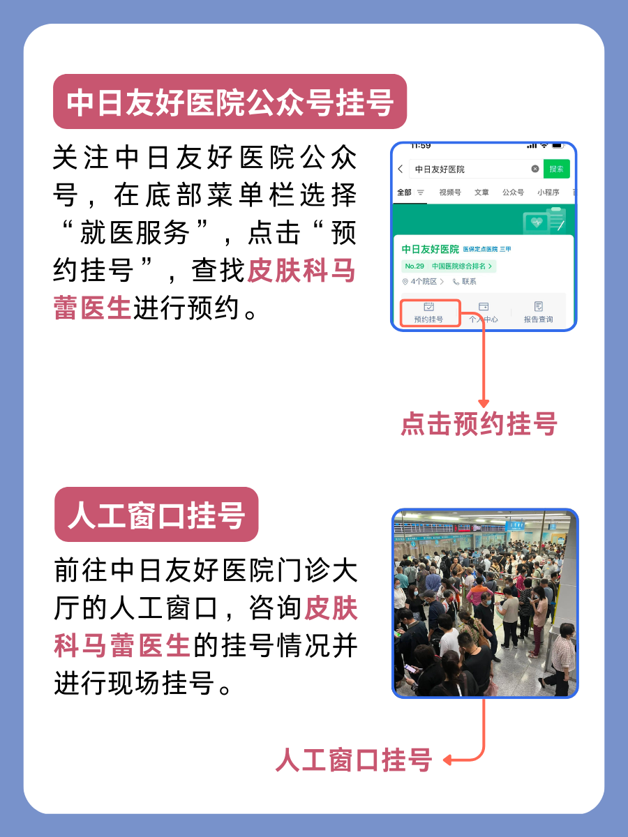 中日友好医院马蕾医生怎么样?怎么挂号?