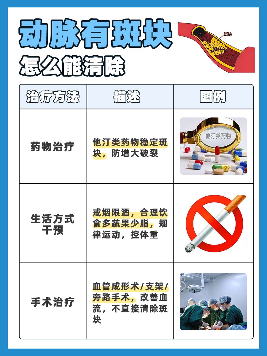 动脉有斑块，怎样才能将其清除？