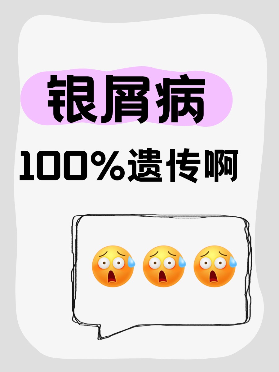 银屑病是100%会遗传吗？别被假象吓倒