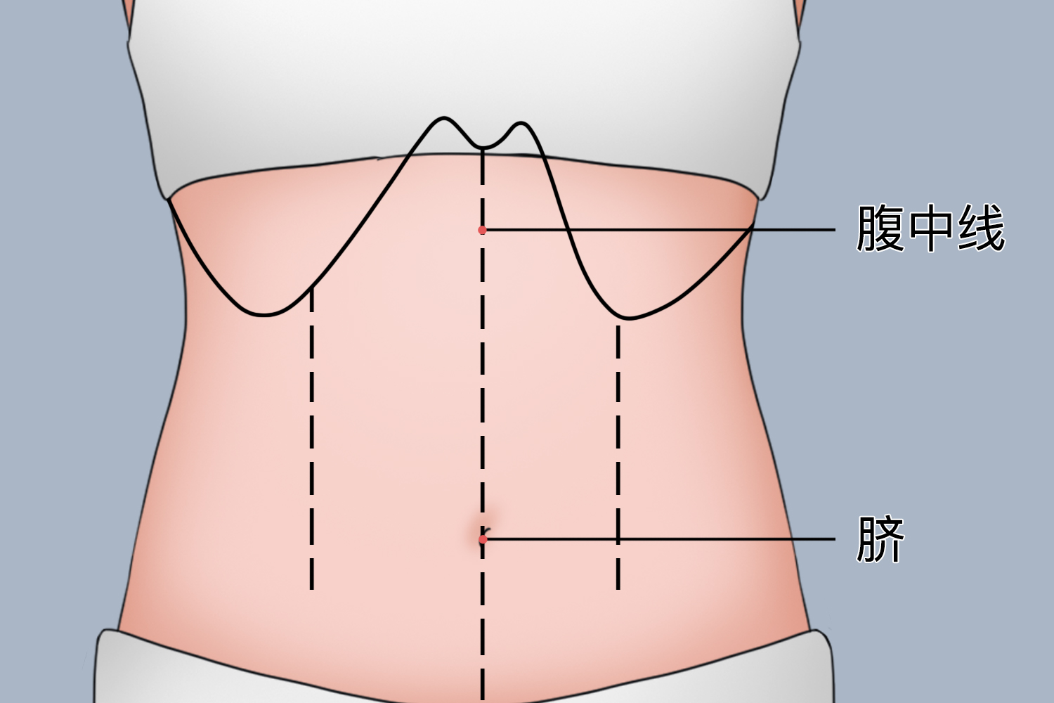 腹部标志线示意图图片