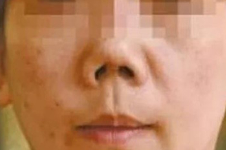 朝天鼻图 朝天鼻图