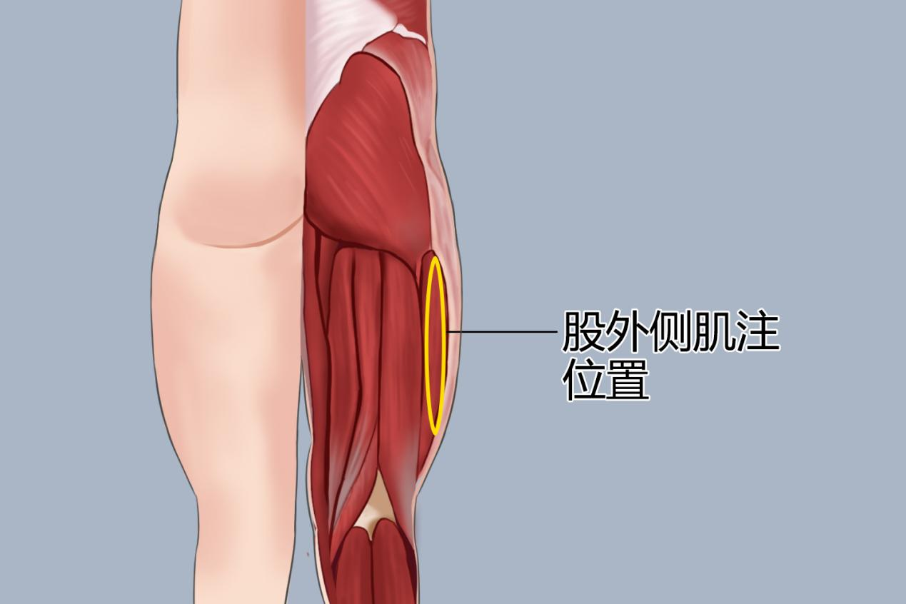 股外侧肌注位置图