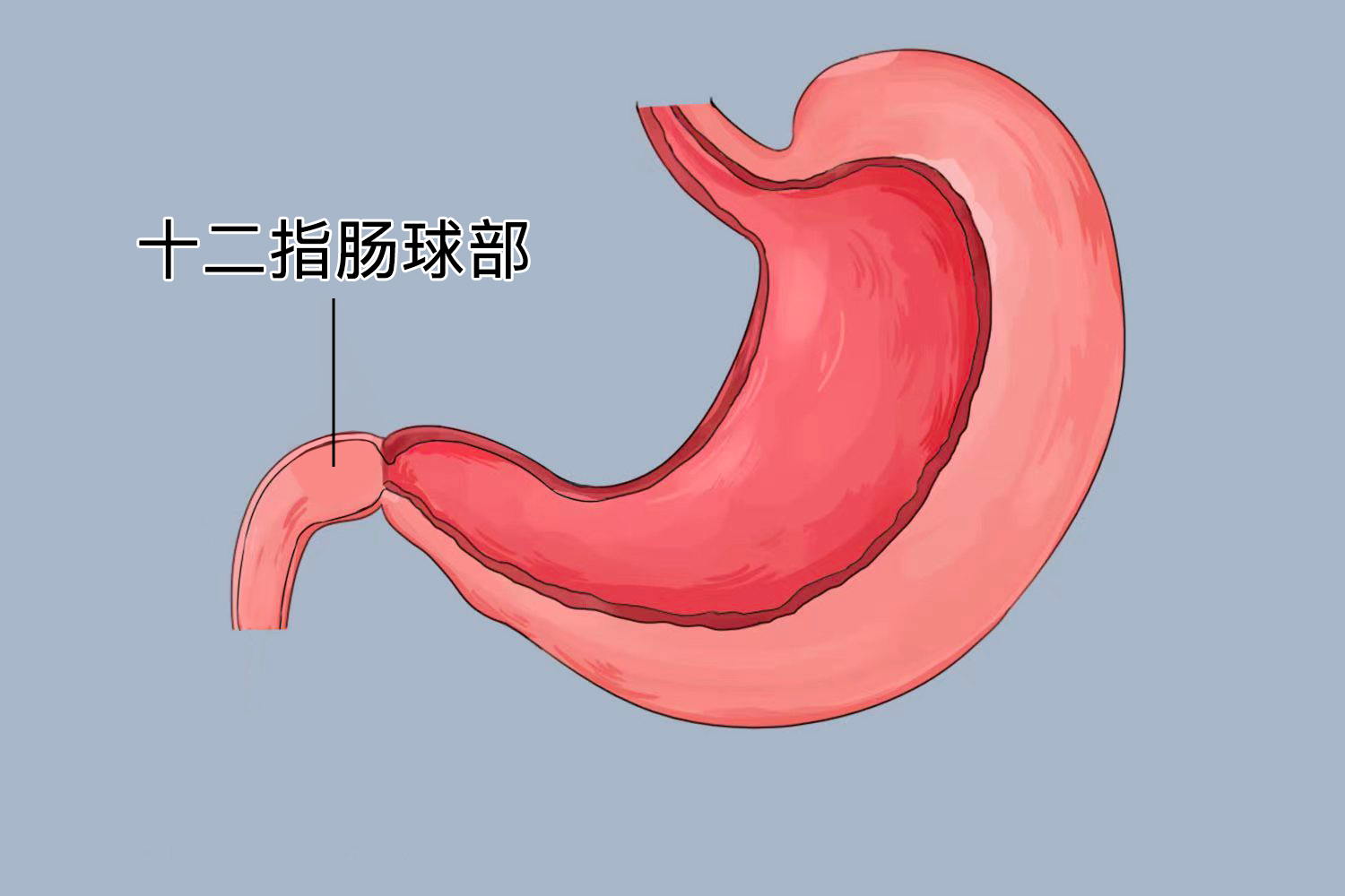 十二指肠球位置图 十二指肠球位置图